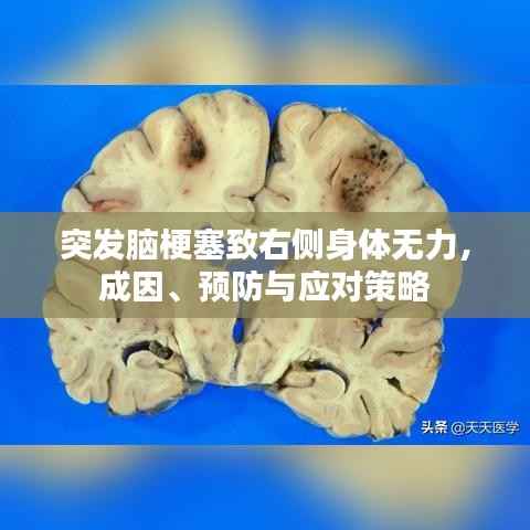 突发脑梗塞致右侧身体无力,成因、预防与应对策略