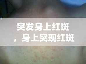 突发身上红斑,身上突现红斑是什么原因